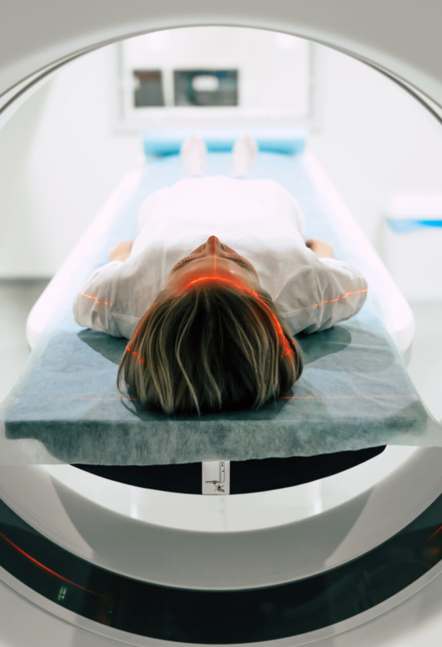 MRI Scan Image